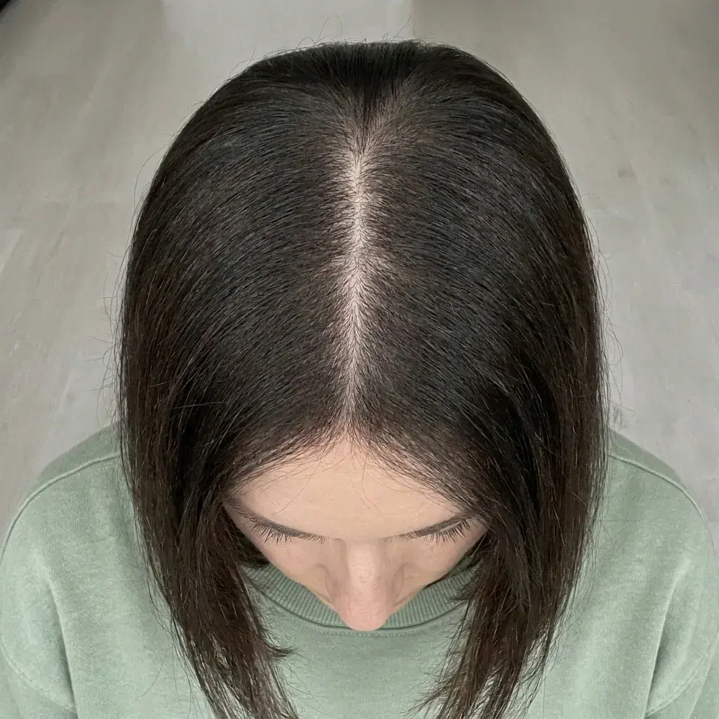 Result — Month 6